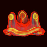 ViV Aortic31.0_rowtechapk.com