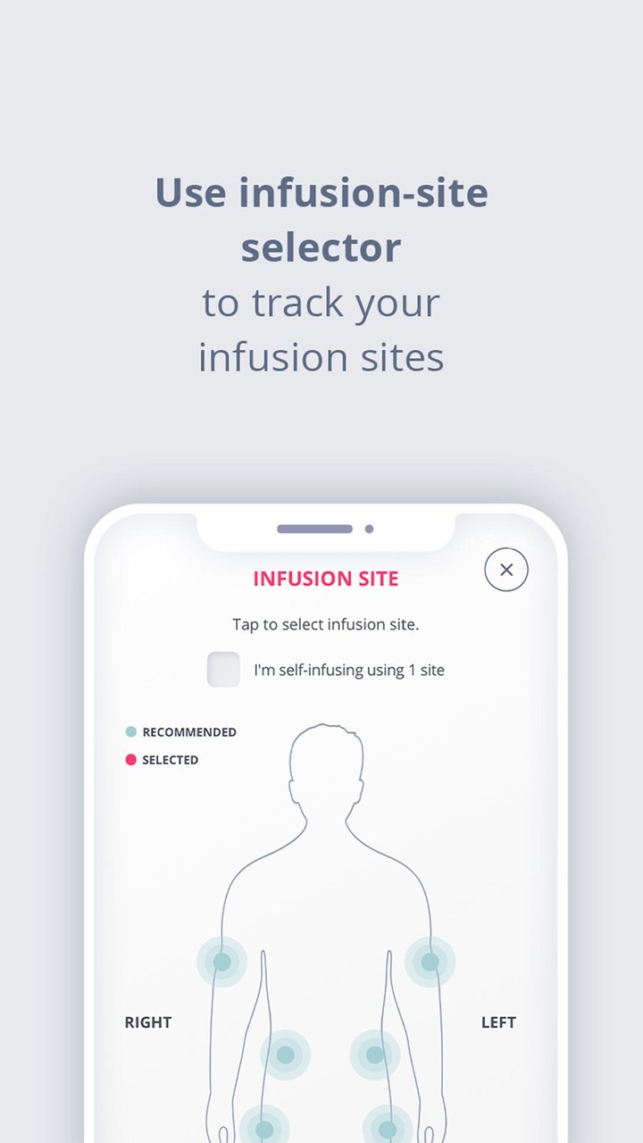 My Infusion Tracker™ screenshot image 1_Popularmodapk.com